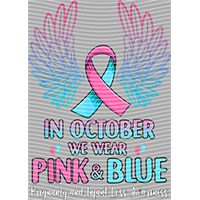 Breast cancer-XA 1026